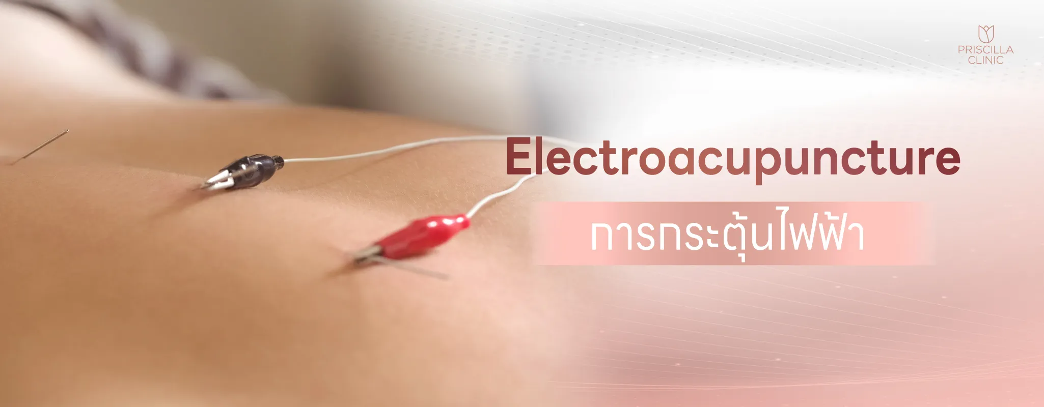 กระตุ้นไฟฟ้า_result