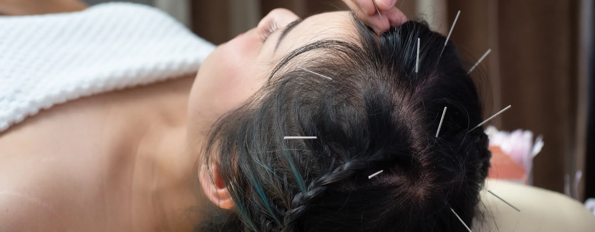 ฝังเข็ม-Slide-1_result