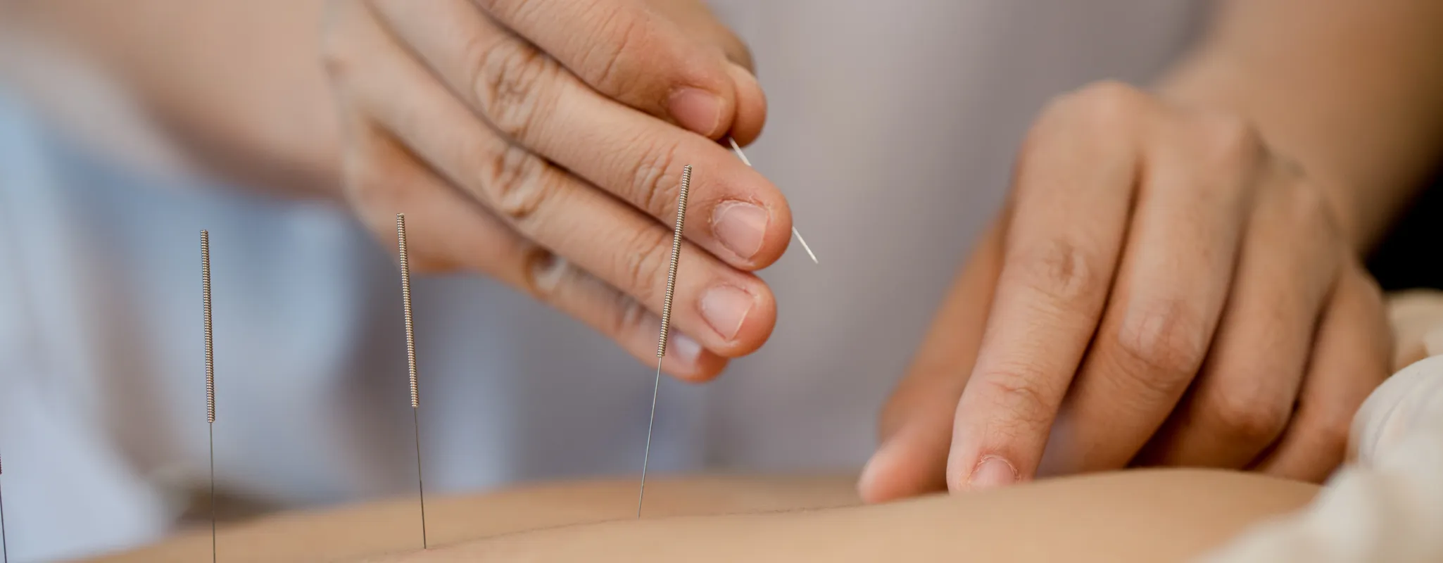 ฝังเข็ม-Slide 3pg_result